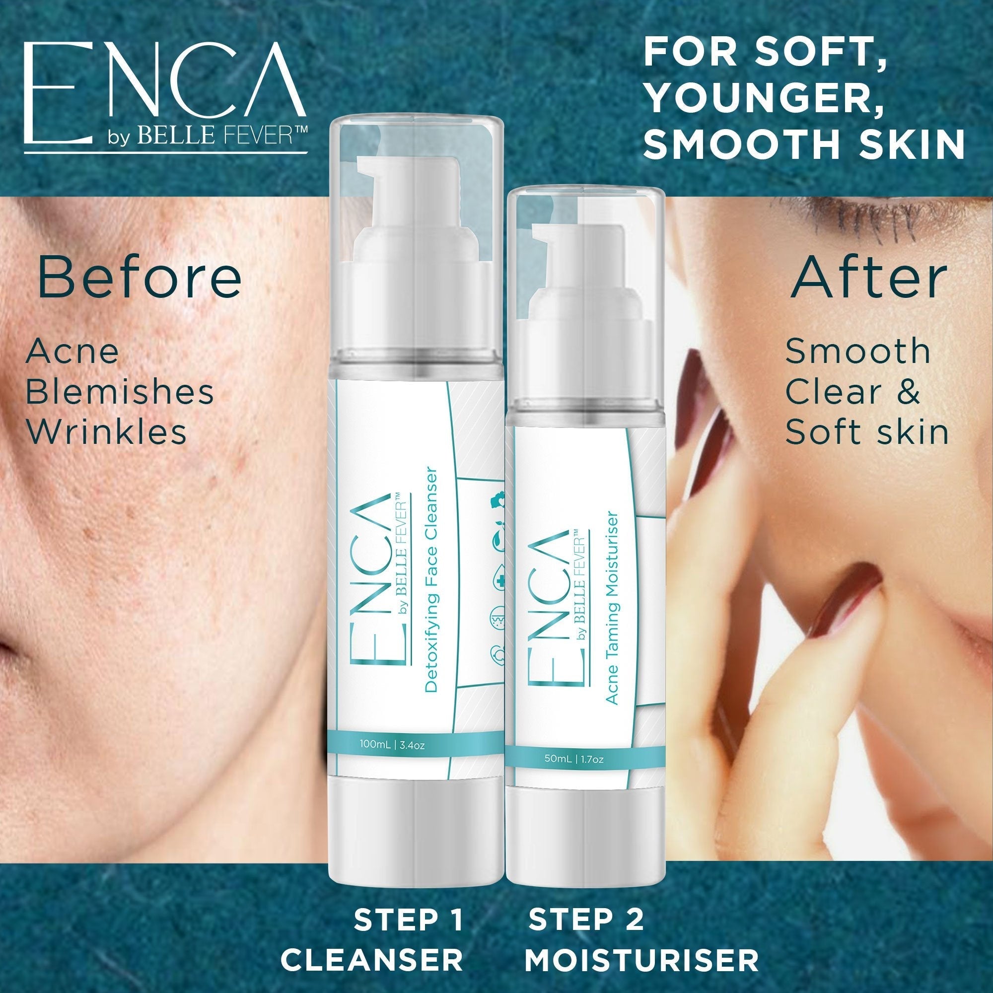 BUY ONE GET ONE Enca Acne Clearing Set - 2 x Cleanser 100ml & 2 x Moisturiser 50ml - Enca Skincare by Belle Fever